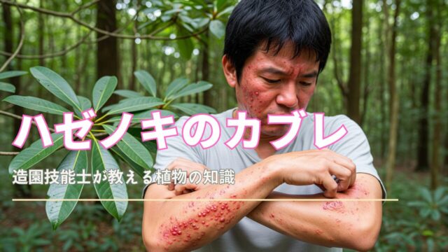 短い黒髪の日本人男性が、ハゼノキによる赤くただれた発疹が顔と腕に広がっている様子。発疹は赤く炎症し、一部は水ぶくれになっている。彼は前腕をかきむしっており、背景にはハゼノキの葉がぼやけて写っている。